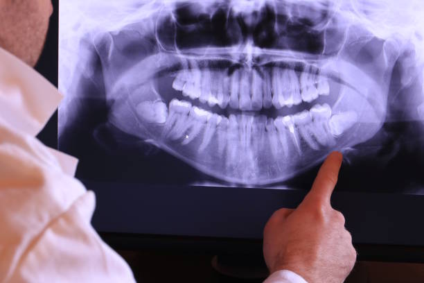 Best Emergency Treatment for Dental Infections or Abscesses in Pelahatchie, MS